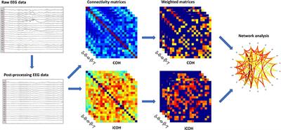 Brain Functional Connectivity in de novo Parkinson's Disease Patients Based on Clinical EEG